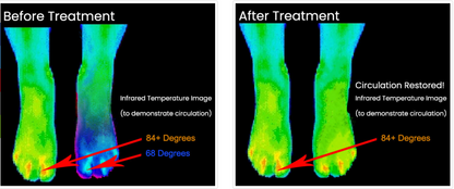 ReBuilder® 2407 Nerve Pain Eliminator - Treat 2 Areas At Once